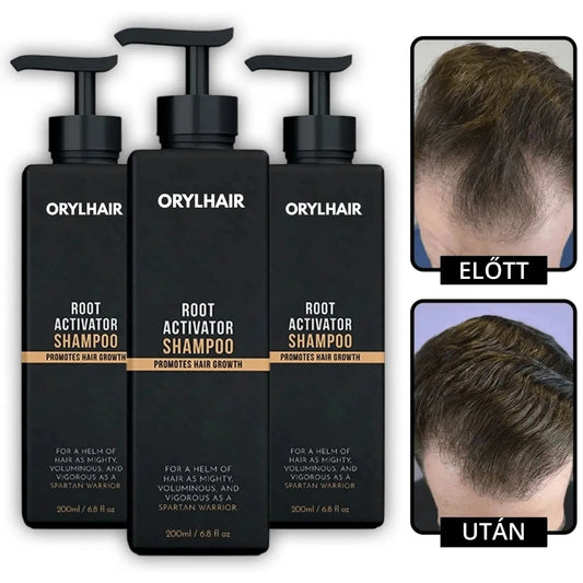 Orylo™ RootBoost Hajrevitalizáló Sampon