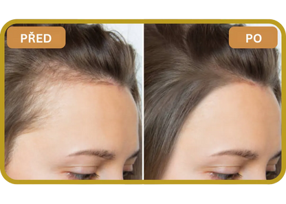 Orylo™ RootBoost Šampon pro regeneraci vlasů v2 (Women)