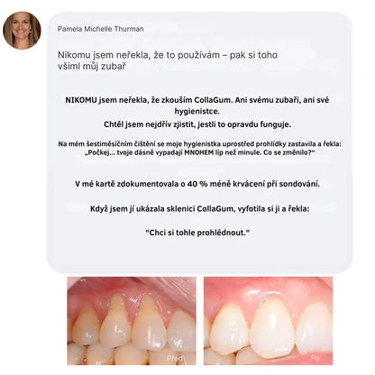 Collagen Powder for Gums