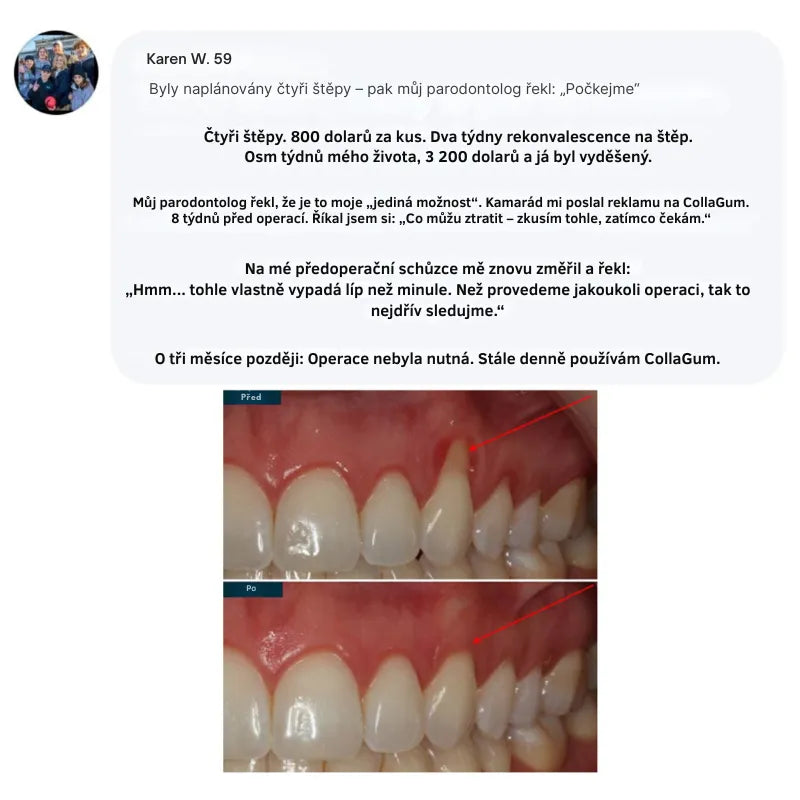 Collagen Powder for Gums