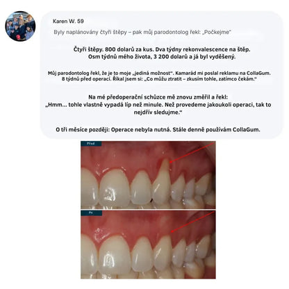 Collagen Powder for Gums