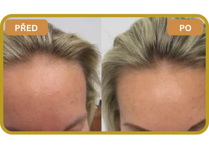 Orylo™ RootBoost Šampon pro regeneraci vlasů v2 (Women)