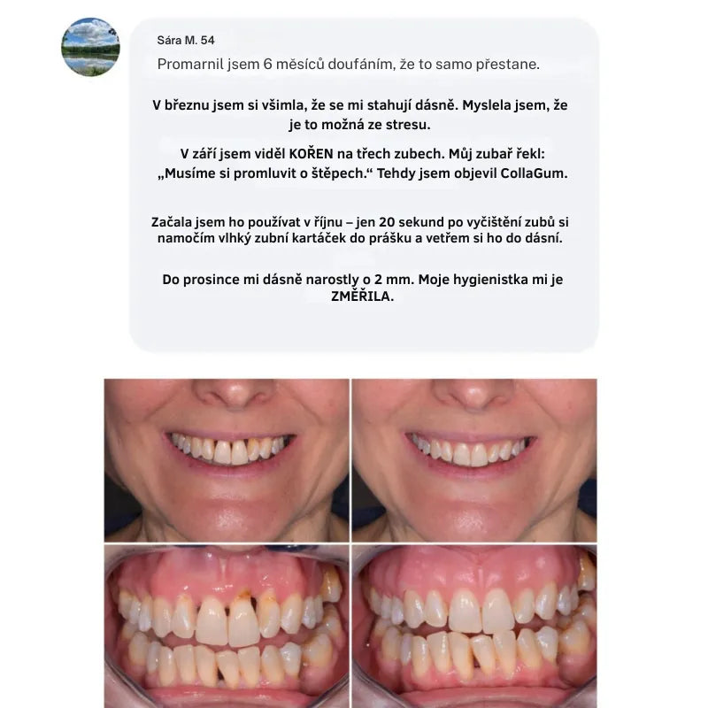 Collagen Powder for Gums