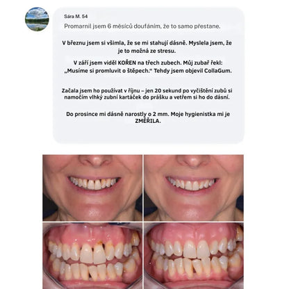 Collagen Powder for Gums