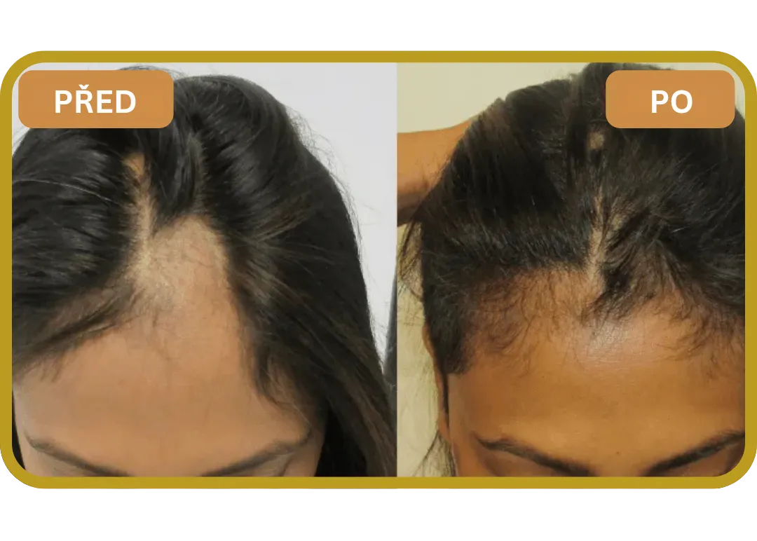 Orylo™ RootBoost Šampon pro regeneraci vlasů v2 (Women)