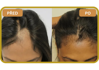 Orylo™ RootBoost Šampon pro regeneraci vlasů v2 (Women)