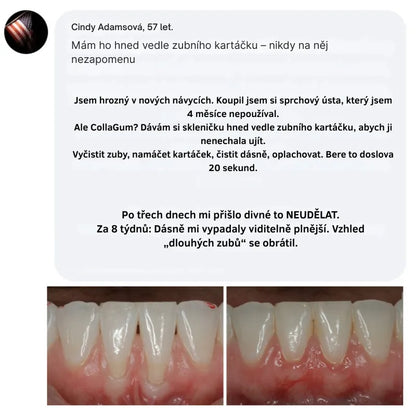Collagen Powder for Gums