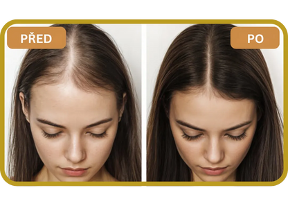 Orylo™ RootBoost Šampon pro regeneraci vlasů v2 (Women)