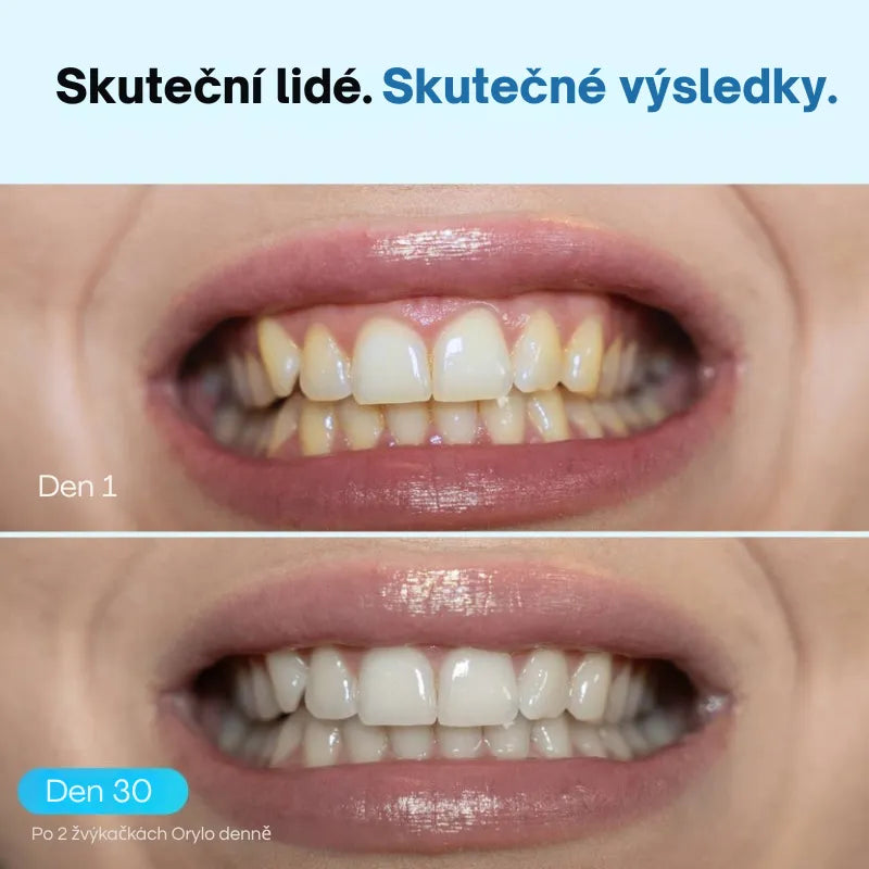 Žvýkačka na bělení zubů