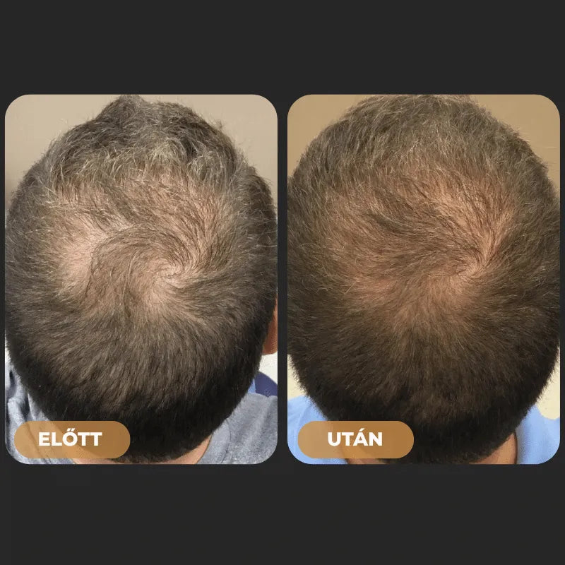 Orylo™ RootBoost Hajrevitalizáló Sampon