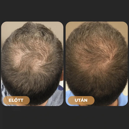Orylo™ RootBoost Hajrevitalizáló Sampon