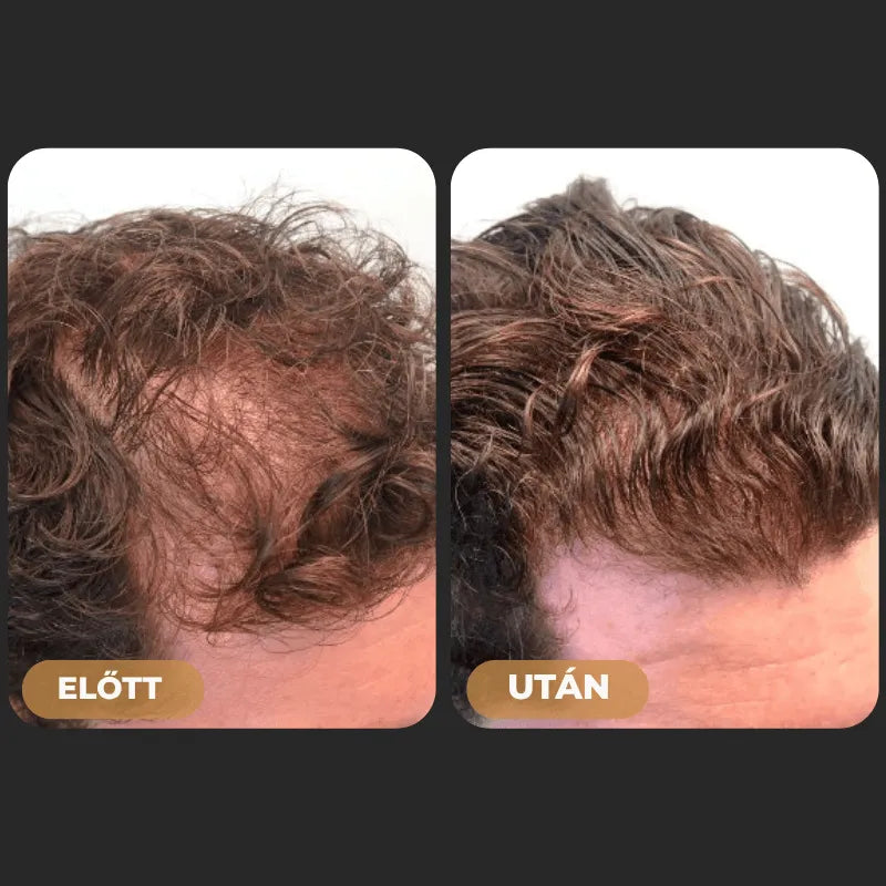 Orylo™ RootBoost Hajrevitalizáló Sampon