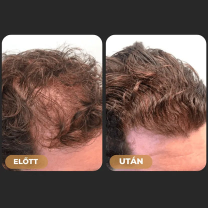 Orylo™ RootBoost Hajrevitalizáló Sampon