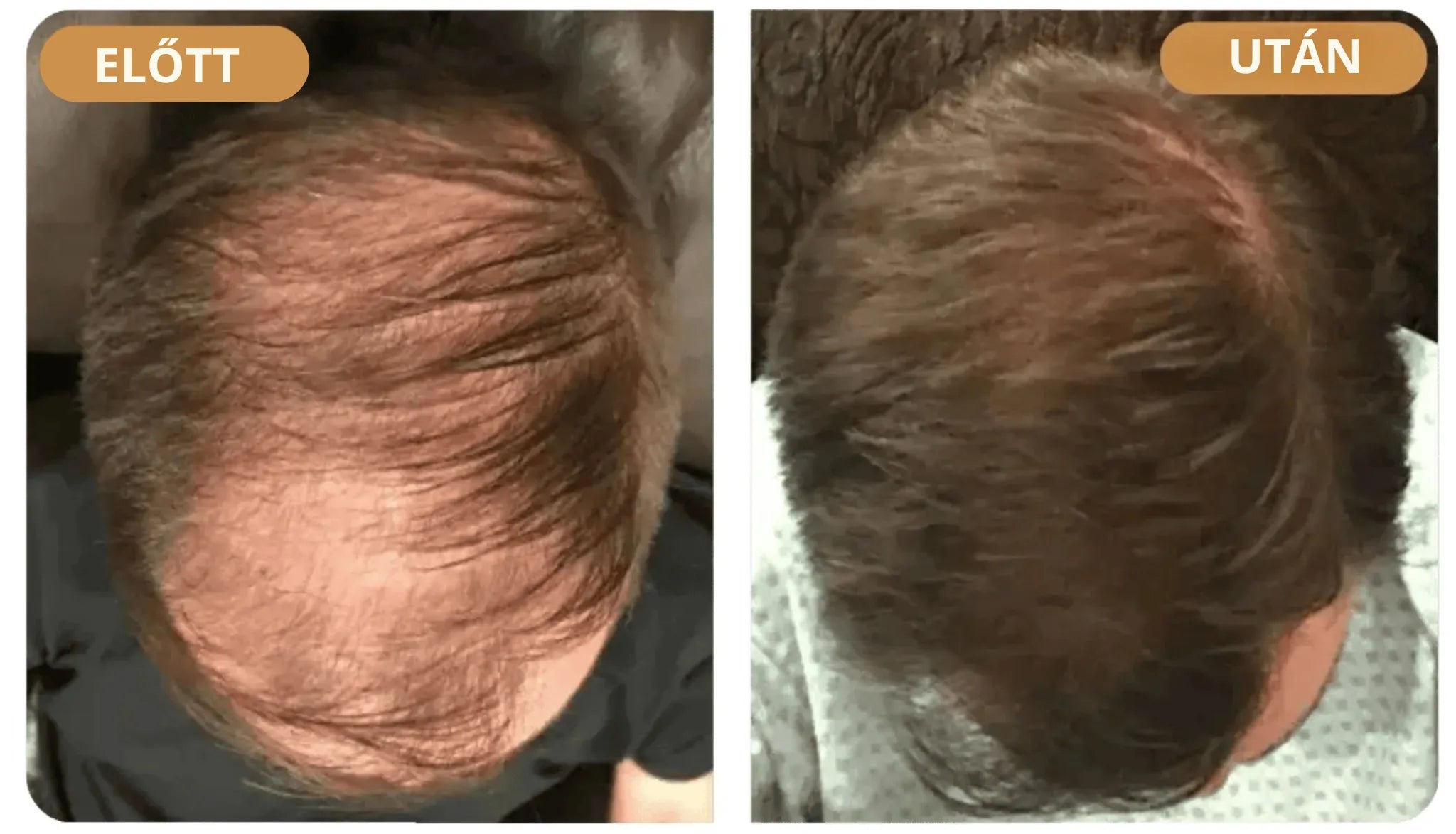 Orylo™ RootBoost Hajrevitalizáló Sampon