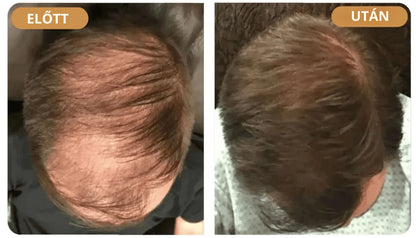 Orylo™ RootBoost Hajrevitalizáló Sampon