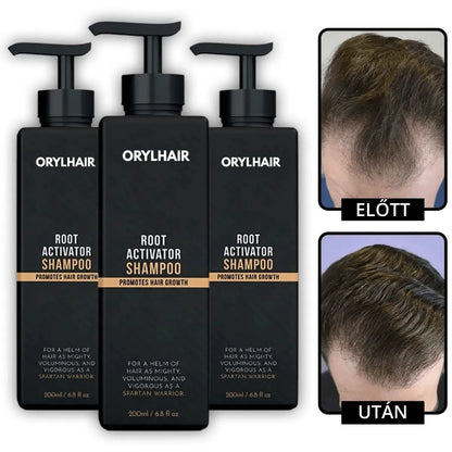 Orylo™ RootBoost Hajrevitalizáló Sampon