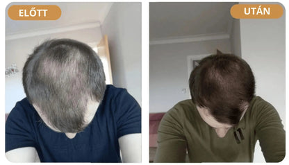 Orylo™ RootBoost Hajrevitalizáló Sampon