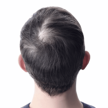 Orylo™ RootBoost Hajrevitalizáló Sampon